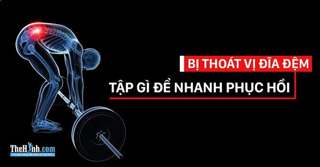 Bị thoát vị đĩa đệm có nên tập gym không, làm sao để nhanh phục hồi ?