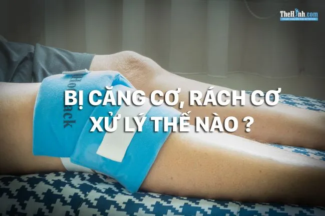 Căng cơ, rách cơ là gì ? Nguyên nhân và cách khắc phục triệt để