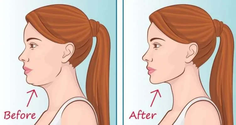 Sự thật về MEWING – Phương pháp thay đổi khuôn mặt đang HOT hiện nay