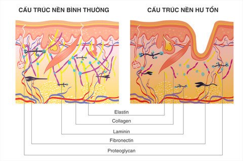 Cách trị rạn da sau sinh, da chảy xệ sau giảm cân tại nhà hiệu quả