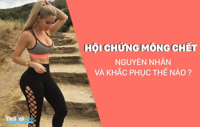 Hội chứng mông chết là gì ? Nguyên nhân và cách khắc phục