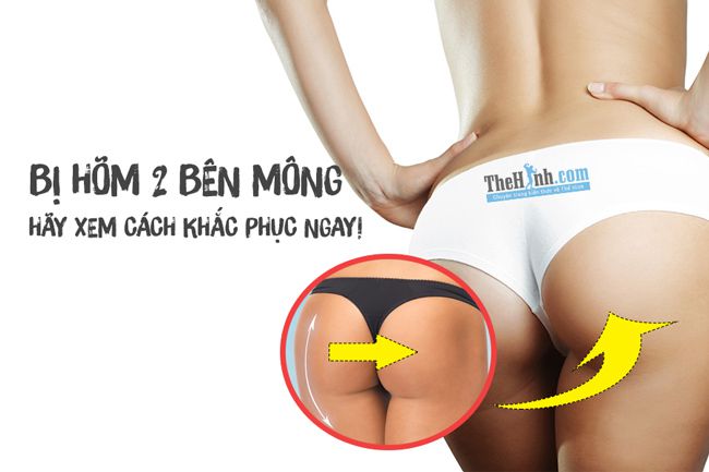 Mông bị hóp 2 bên, hãy khắc phục mông hóp bằng những bài tập này