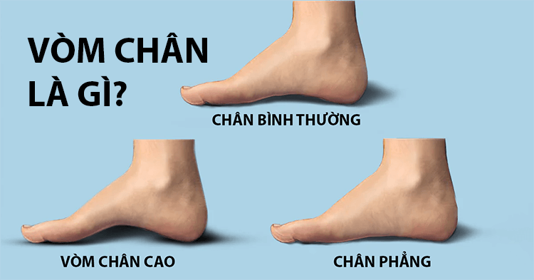 Vòm chân là gì ? 5 Cách xác định bị vòm cân cao, thấp hoặc bình thường