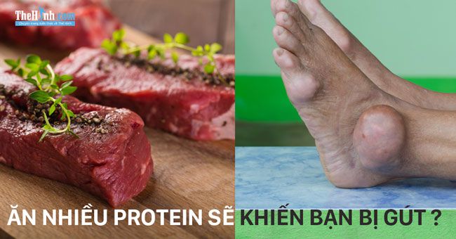 Bệnh Gút | Ăn nhiều protein trong thể hình có phải nguyên nhân làm bạn bị Gút ?